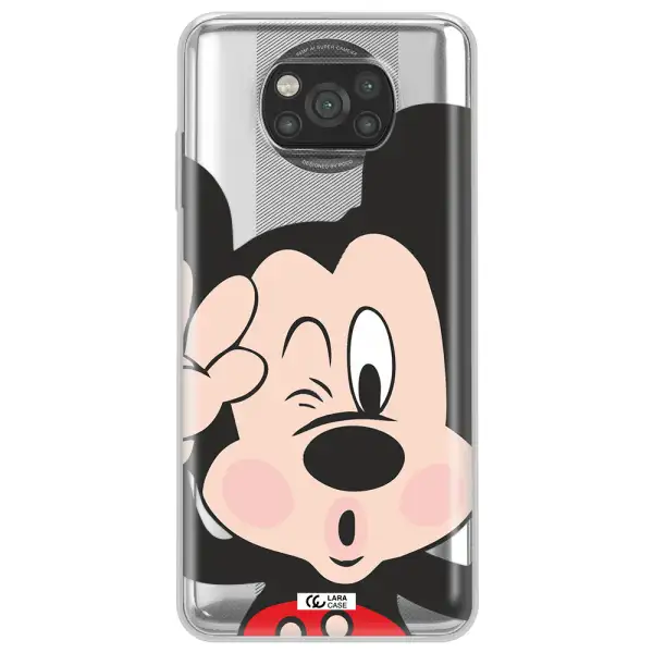 Mickey Mouse Xiaomi Poco X3 Clear TPU Case