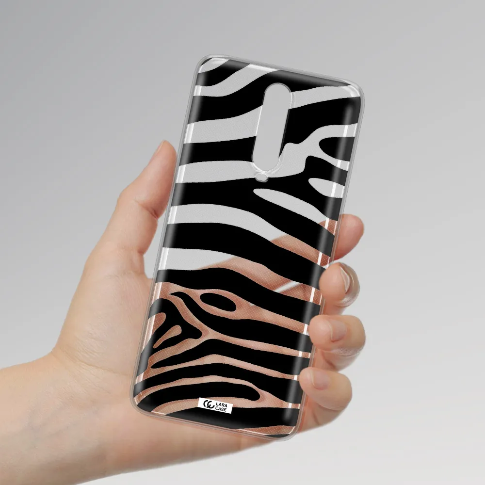 Zebra Xiaomi Redmi K30 Clear TPU Case