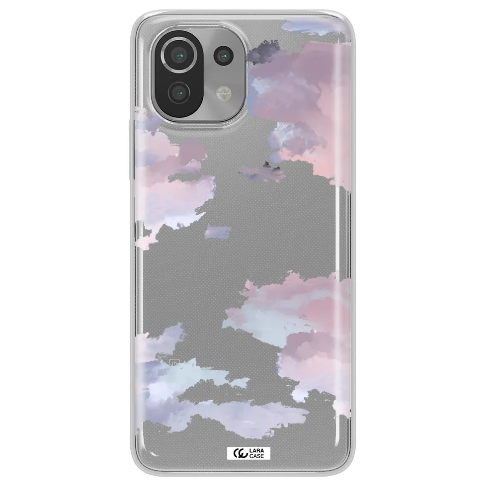 A Close-Up Of A Cloud Xiaomi Mi 11 Lite Clear Tpu Case